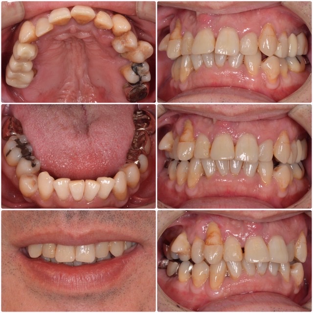 全体的に治したい　50代男性　2024.5.10