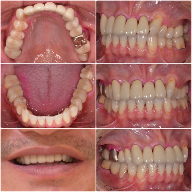 歯を綺麗にしたい2024.5.17