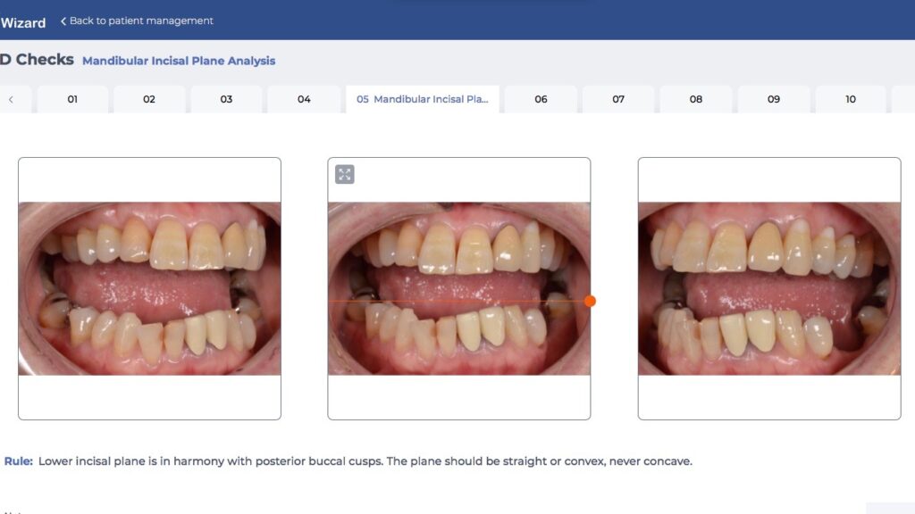 歯並びの歪みを治すセラミック治療　2024.12.2