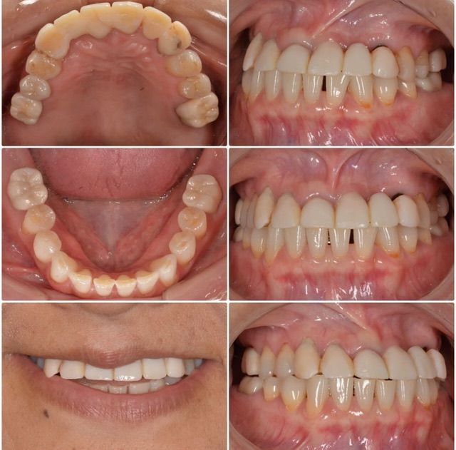人前に出る仕事をしている為、綺麗にしたい2024.12.20