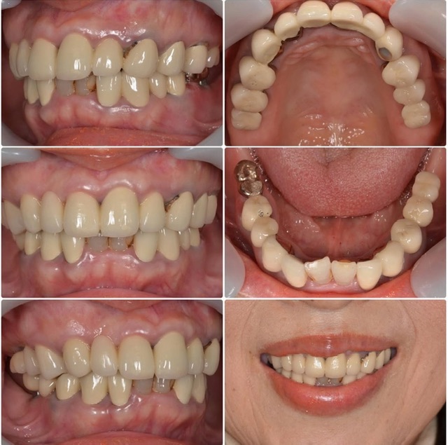 全て綺麗に治したい2025.3.14