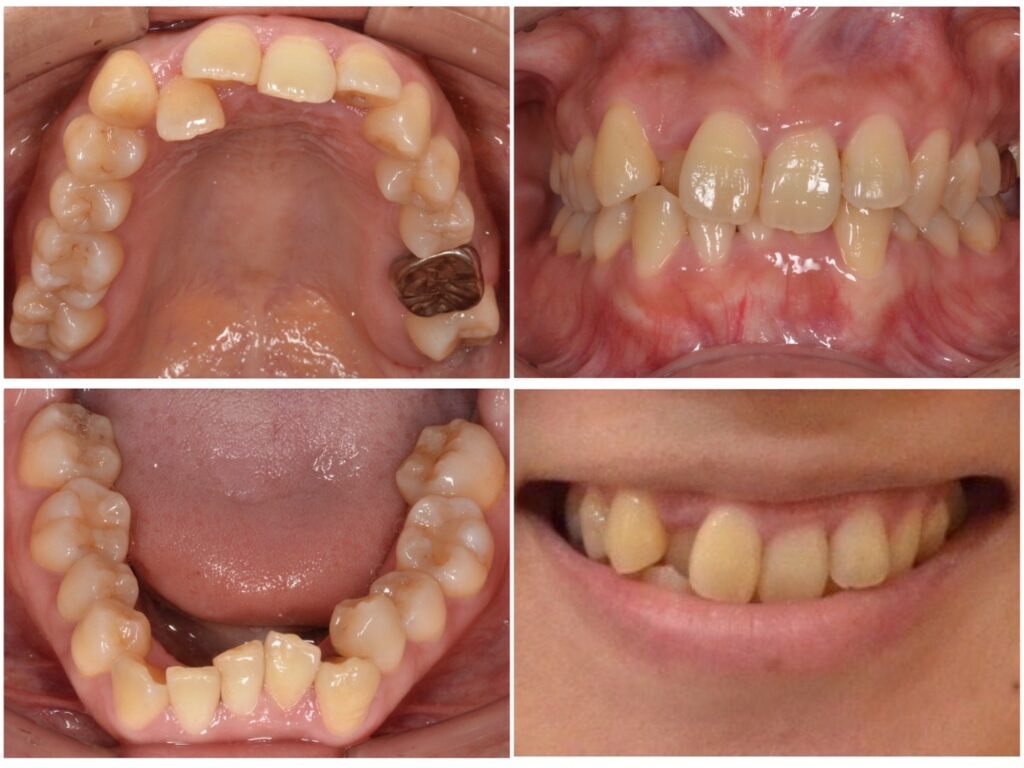 全体的に綺麗に治したい　30代女性　2025.5.26