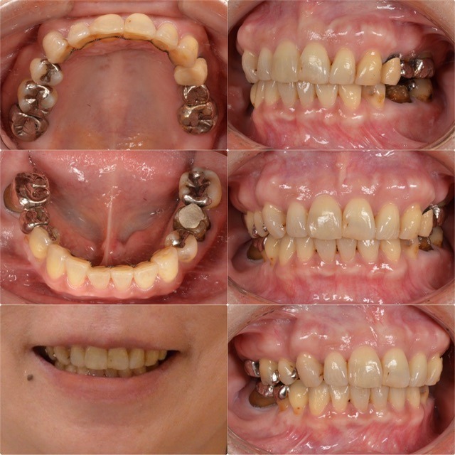他院で矯正したが納得いかない2025.8.18