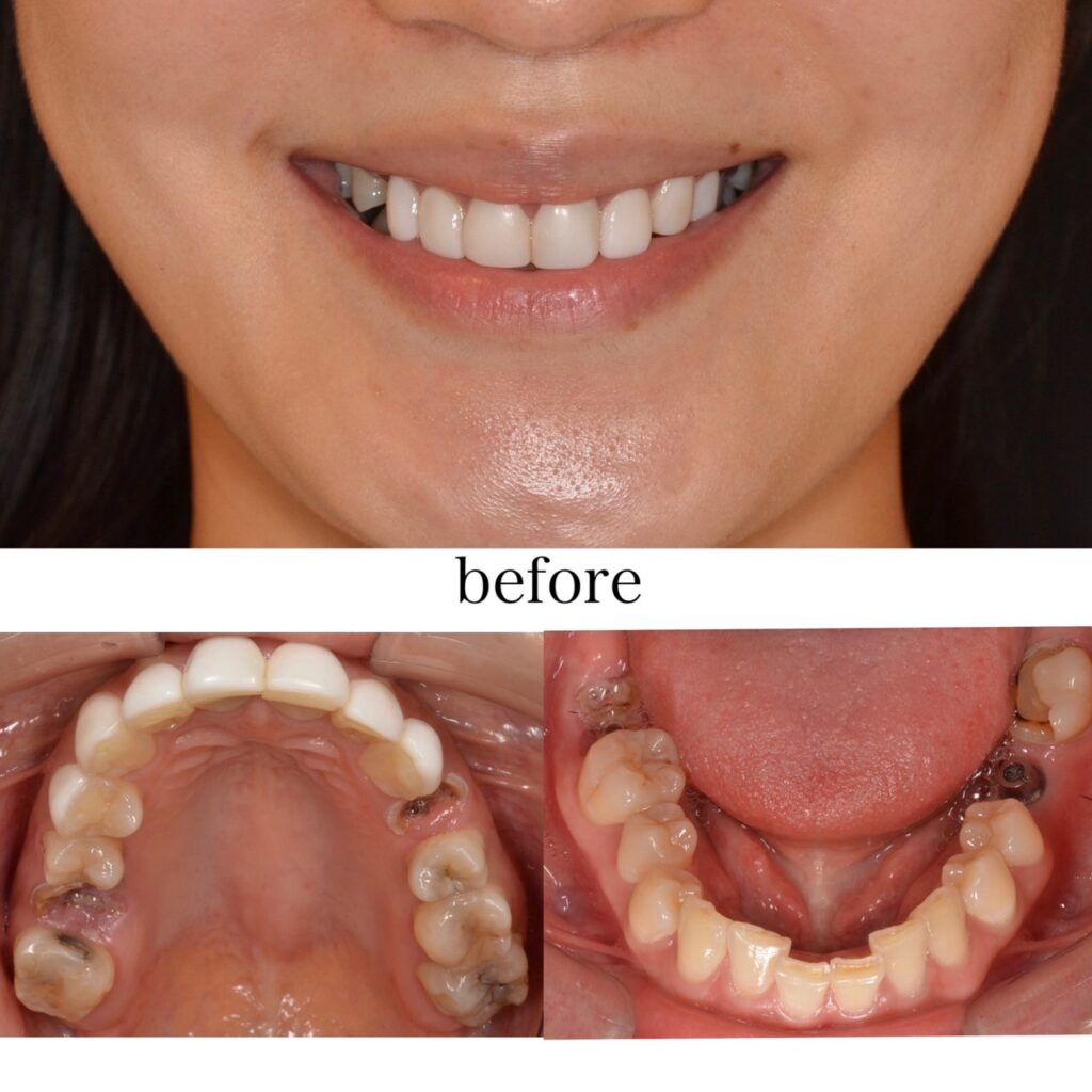 夏のダメージをリセット！　2025.09.03