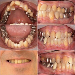 歯並びを改善したい2025.11.21