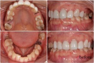 年末前ケア　2025.11.27