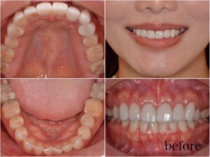 一年のご褒美を… ♡ 2025.12.04