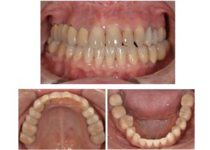 気になるところをやり直したい　40代女性　2025.12.9