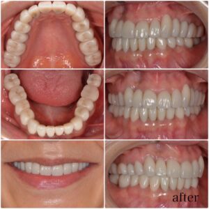 冬のインフル・風邪対策に「口腔ケア」　2025.12.11