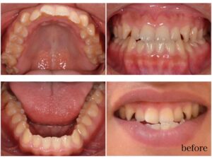 今年中に矯正治療を！　2025.12.18