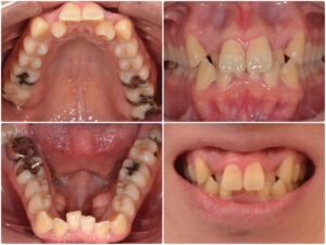 歯並びを綺麗にしたい 30代男性　2026.2.18