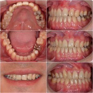 見た目、歯並びが気になる