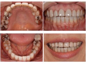 横顔美人について　2026.04.15