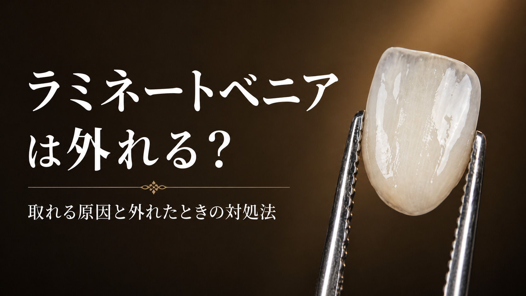 ラミネートベニアは外れる？取れる原因と外れたときの対処法