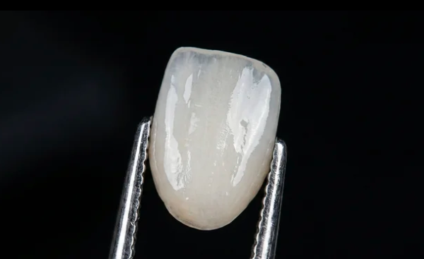 ラミネートベニアに使用する薄いセラミックのイメージ