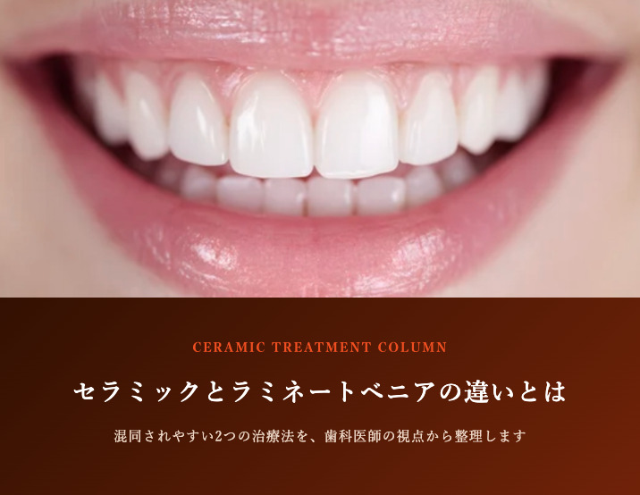 セラミックとラミネートベニアの違いとは