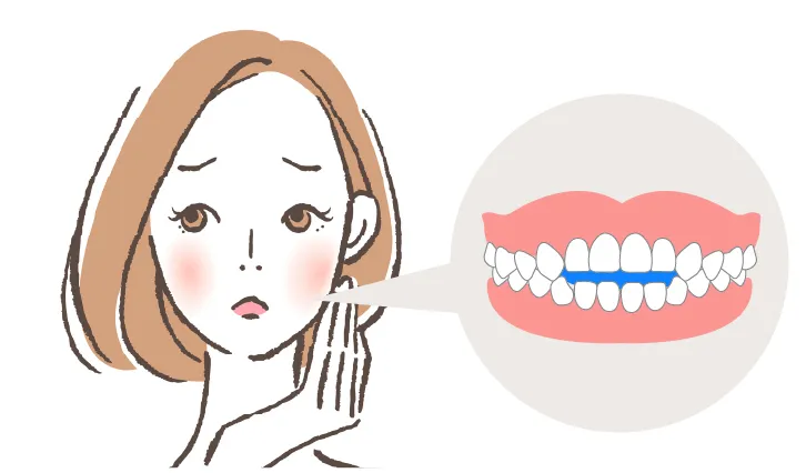 噛みにくい、発音しにくいなど機能障害があるもの