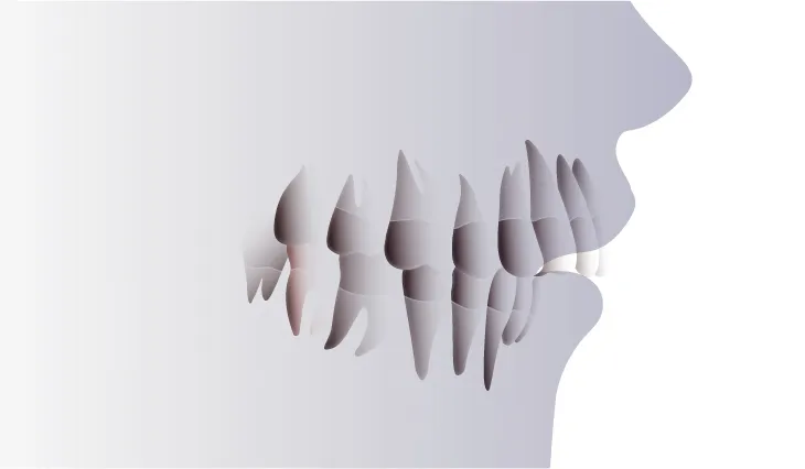 歯や顎が原因で唇が閉じにくいもの