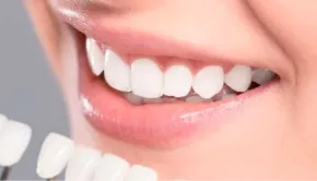 ホワイトニング