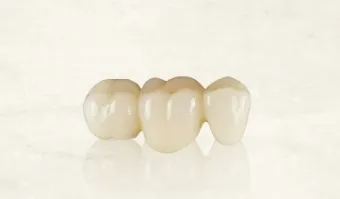 「メタルフリー」推奨医院