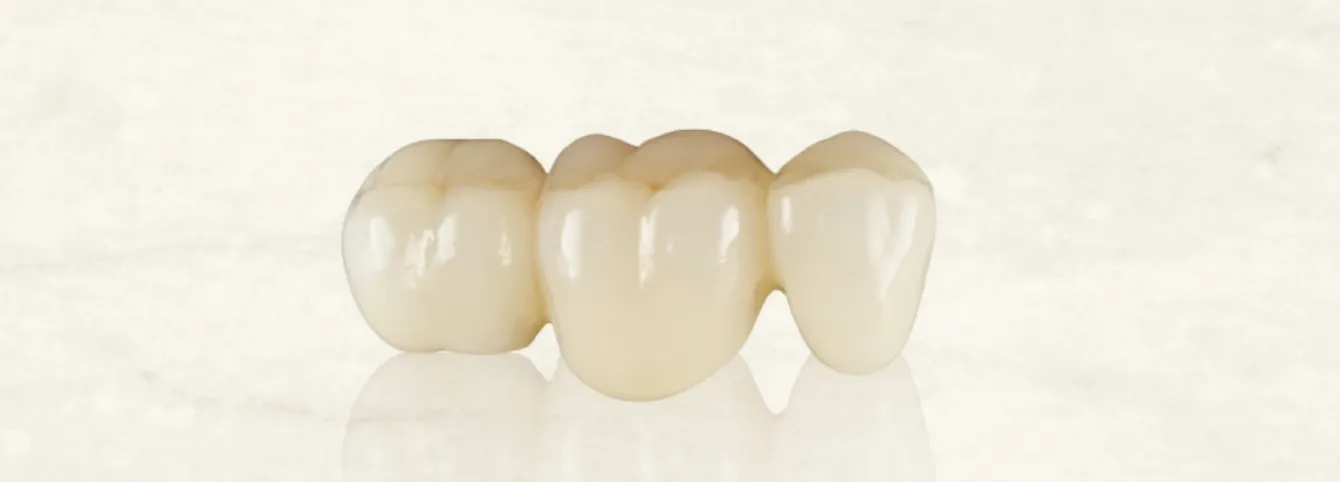 「メタルフリー」推奨医院